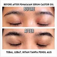 Castor Oil Untuk Menebalkan Alis